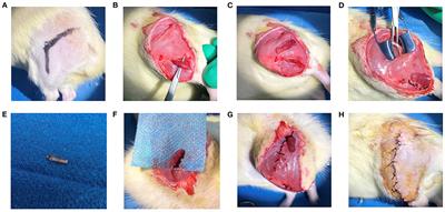 Regenerative Peripheral Nerve Interfaces Effectively Prevent Neuroma Formation After Sciatic Nerve Transection in Rats